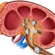 Illustration for article titled obat ginjal dan batu ginjalem/em